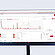 Computer monitor displaying Raman spectroscopy analysis using Anton Paar Spectroscopy Suite software. The screen shows spectral data, measurement acquisition details, and processing options for molecular composition analysis.