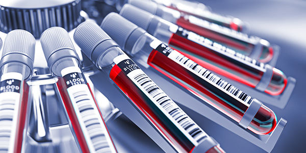 Differentiating between normal and pathological red blood cells