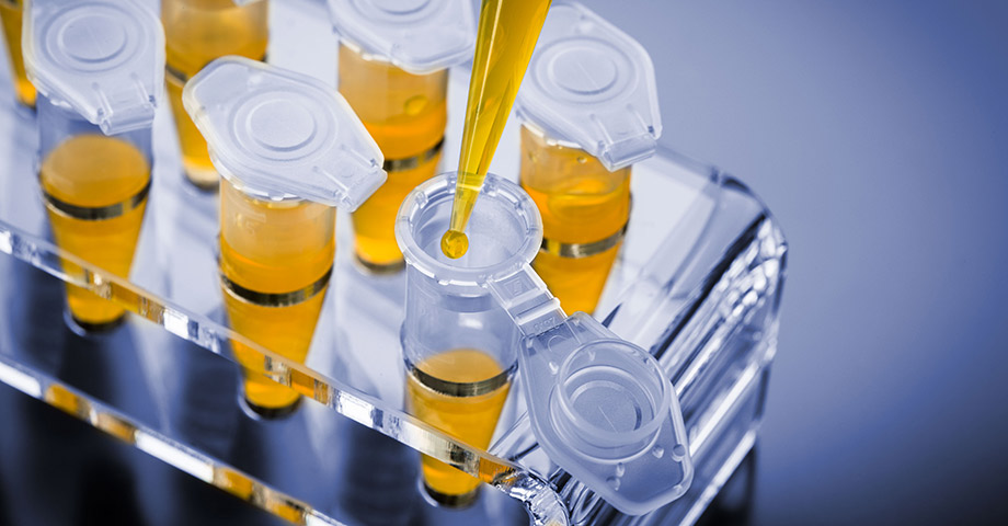 Analyse de pureté efficace et automatisée de produits sucrés Analyse de pureté efficace et automatisée de produits sucrés